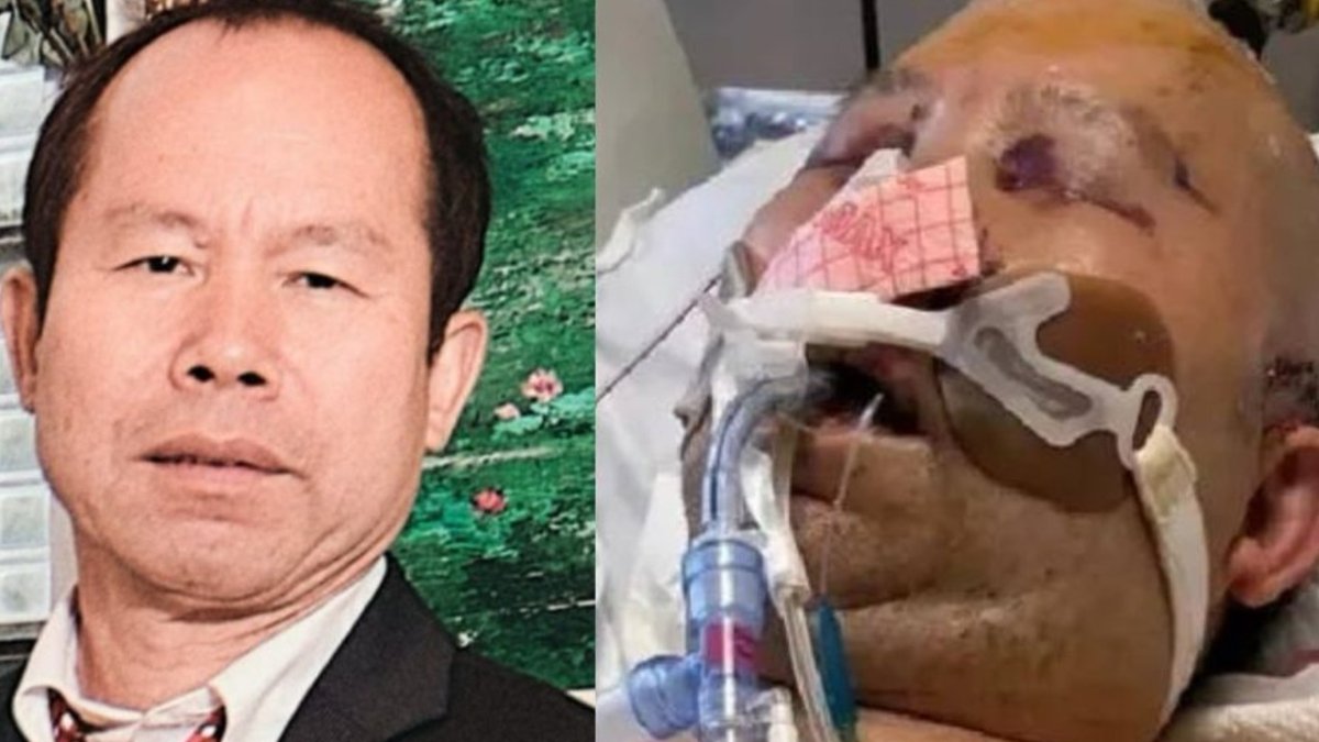 'Robbed, Brutally Beaten and Left For Dead.' Family Shares Story After Finding Father in Coma Following Carjacking – NBC Chicago - Vimarsana News