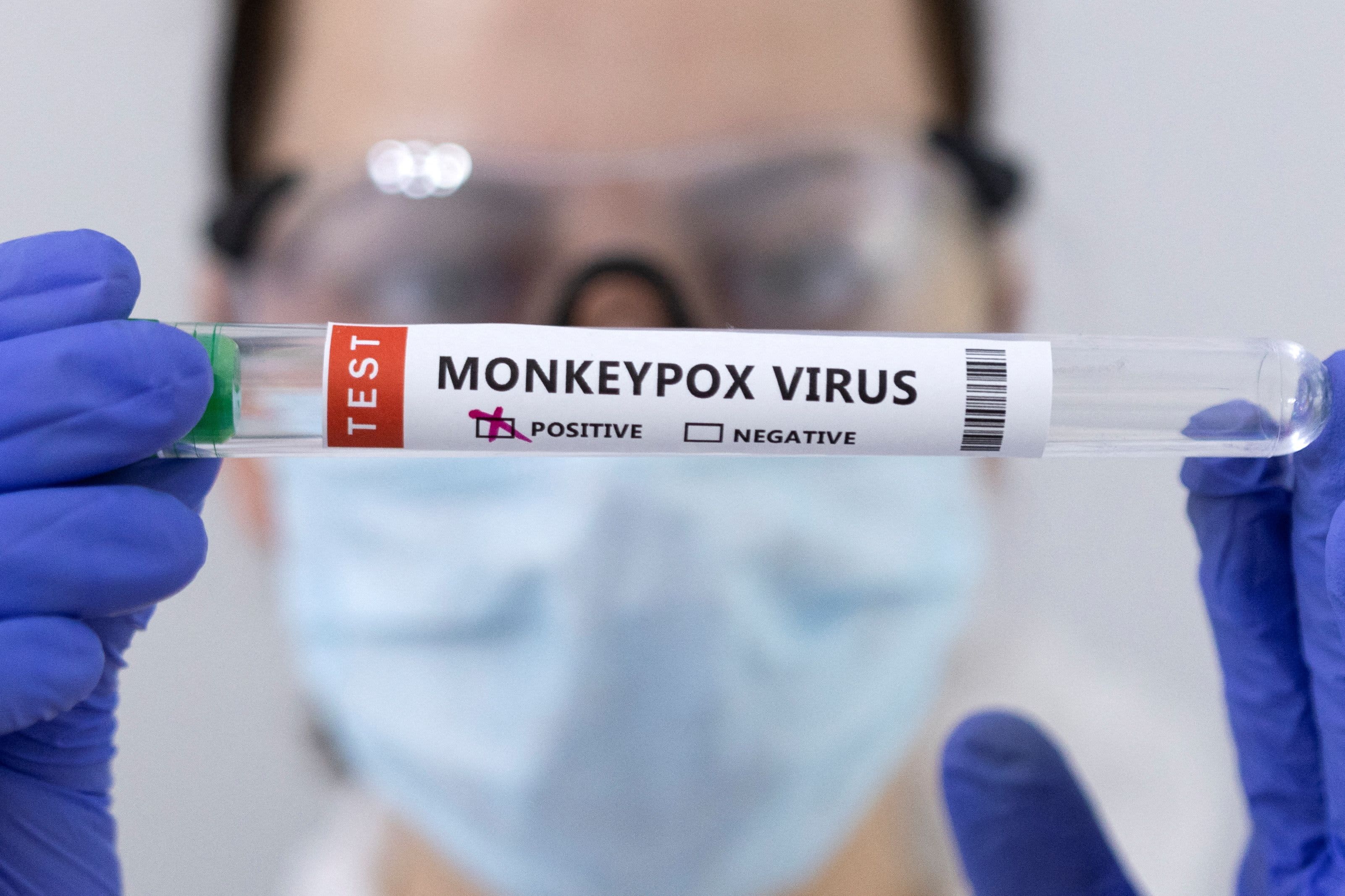 Illinois Has Seen Monkeypox Before, But Doctors Say These US Cases Are Different. Heres What We Know