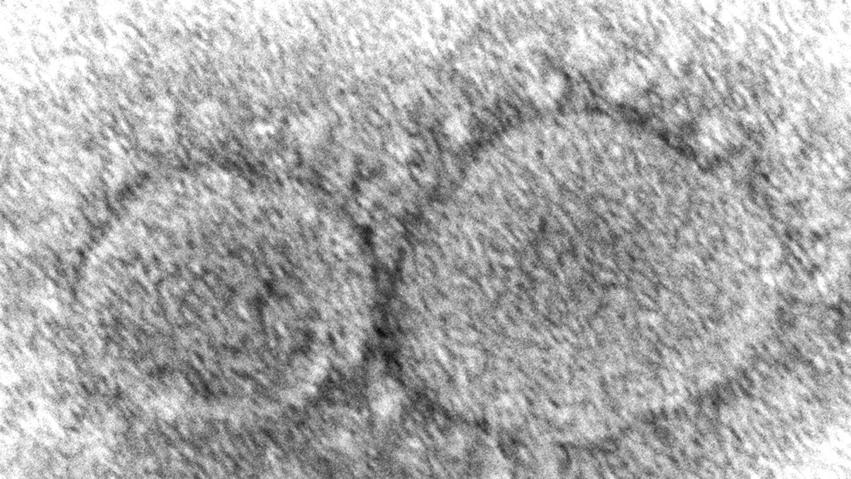 Dominant Coronavirus Mutant and New Subvariants Contain Ghost of Pandemic Past - Vimarsana News