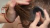 Kids With Head Lice Should No Longer Be Sent Home From School, New Study Says