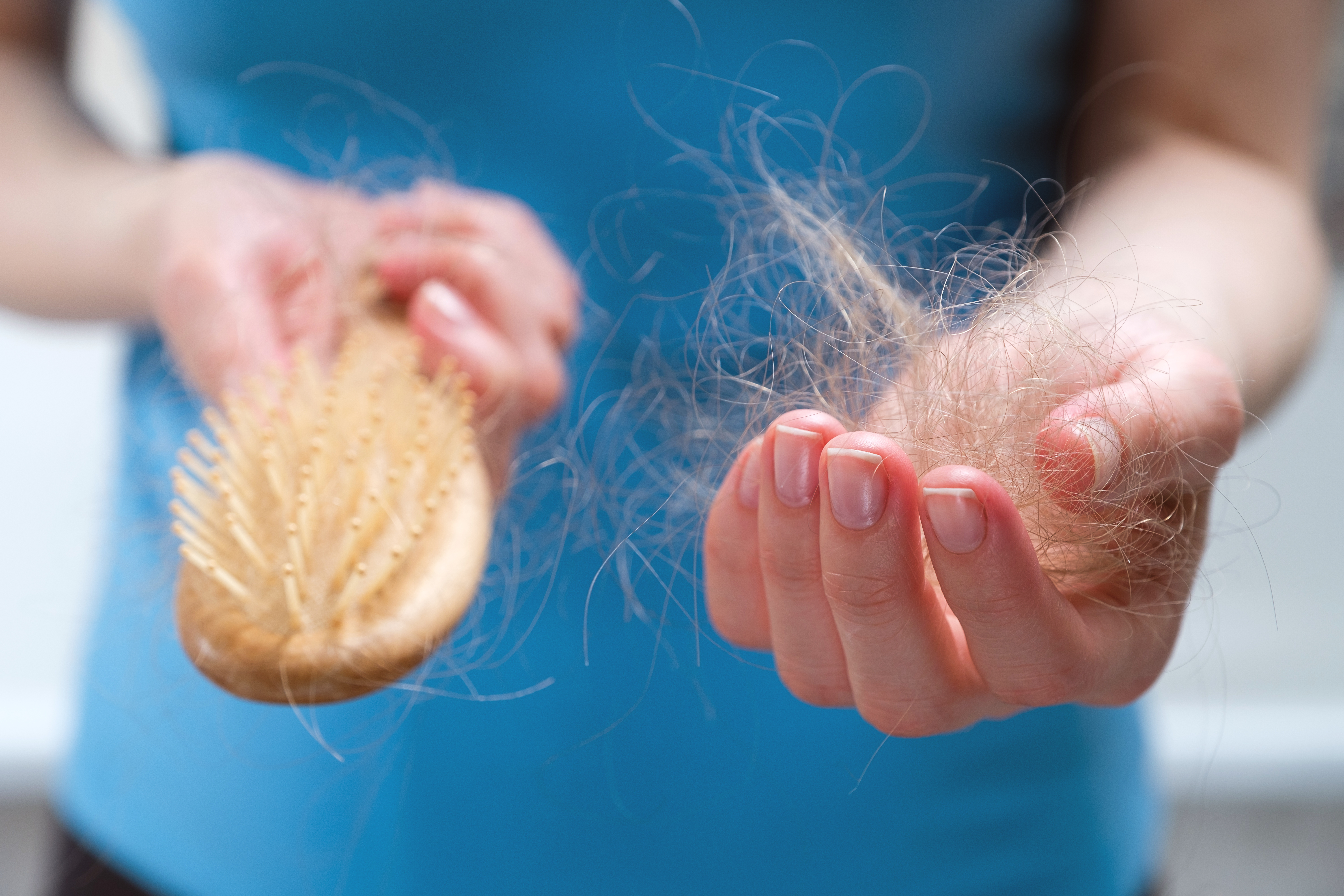 Can COVID Cause Hair Loss? Why Some Experience It and Other Long Symptoms