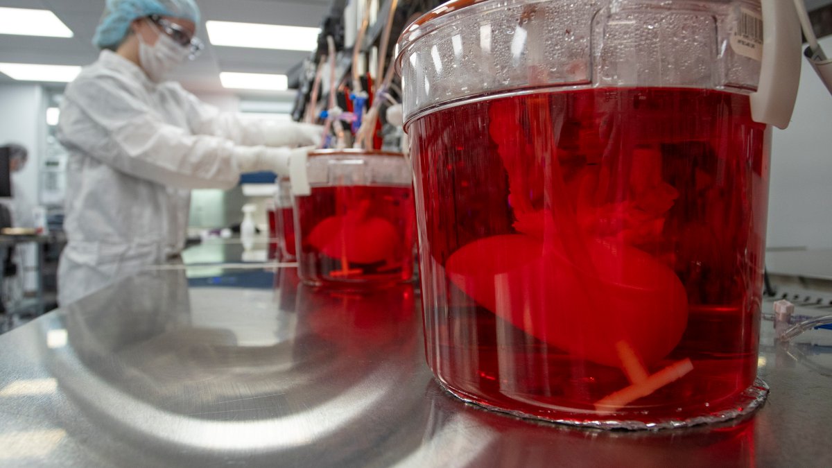 Scientists Seek to Use Pig Livers to Ease Organ Shortage – NBC Chicago - Vimarsana News