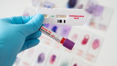 CDC says why COVID guidelines were changed for 2024 – NBC Chicago