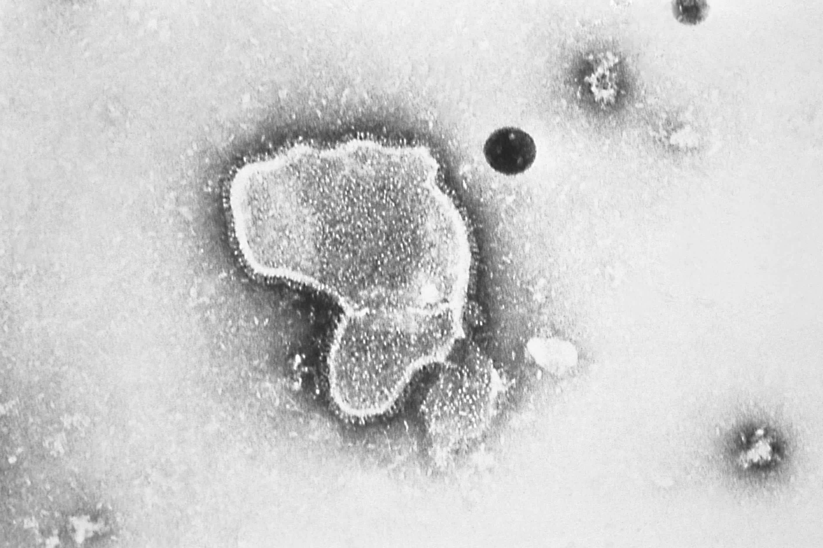 FDA Says Guillain-Barre Syndrome Is Possible Risk of Pfizer's RSV Vaccine for Older Adults - Vimarsana News