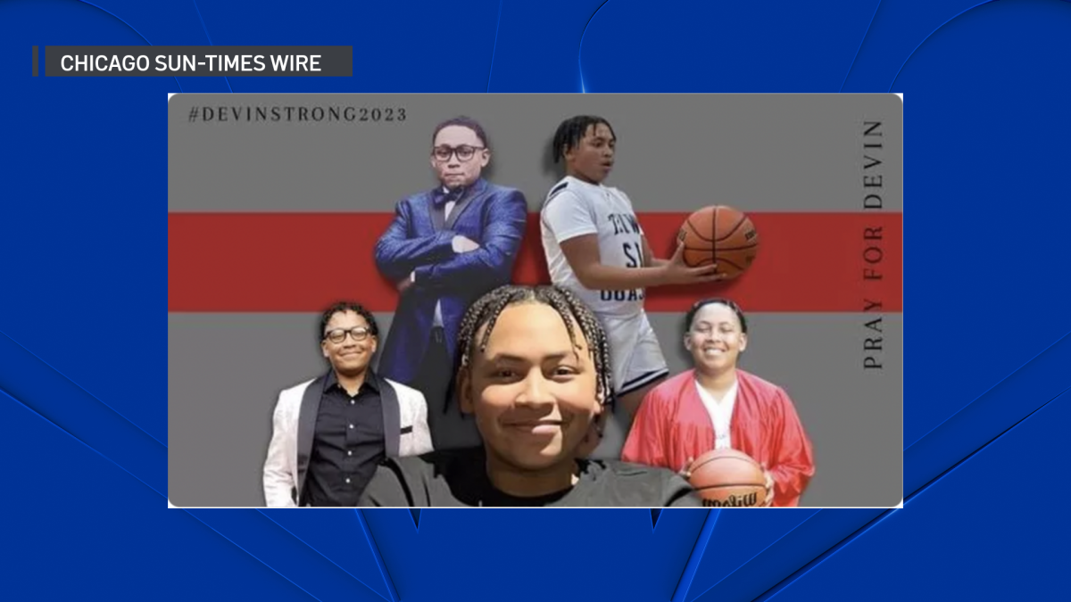 Boy, 16, on Path to ‘Miracle’ Recovery After Being Shot in Head at