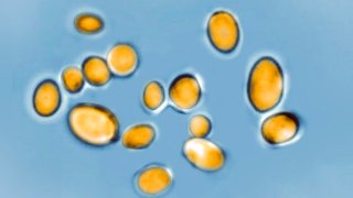 Candida auris is a yeast responsible for many infections. Resistant to most anti-fungal drugs, this fungus causes several deaths worldwide.