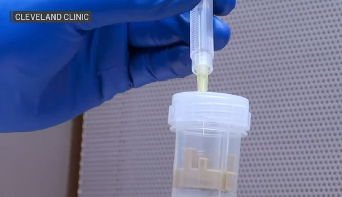 Breast Cancer Vaccine Trial Produces ‘Promising’ Results – NBC Chicago