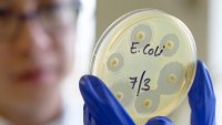 Nueve casos confirmados de E. coli reportados en una escuela secundaria suburbana