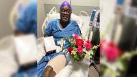 Florida man almost loses leg to flesh-eating disease after getting bitten in a family brawl