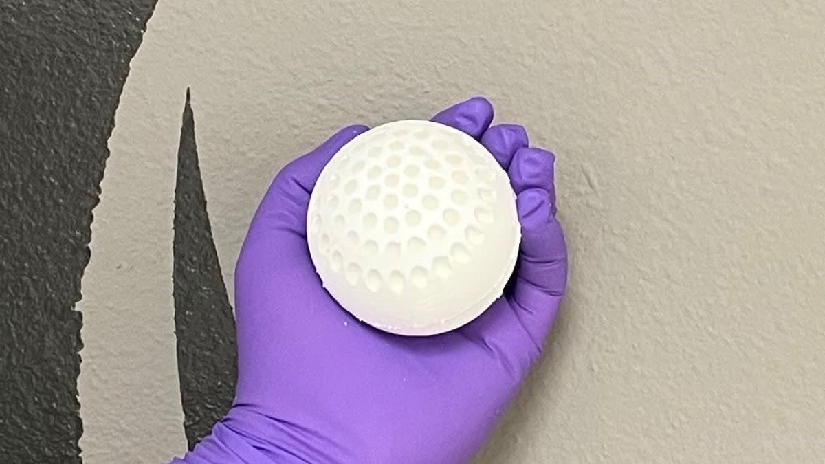 Khosla Ventures backs effort to build 'orchards' of 'fruit' with lung-like material to remove CO2 from the air – NBC Chicago - Vimarsana News