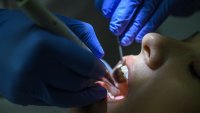 Many states are expanding their Medicaid programs to provide dental care to their poorest residents