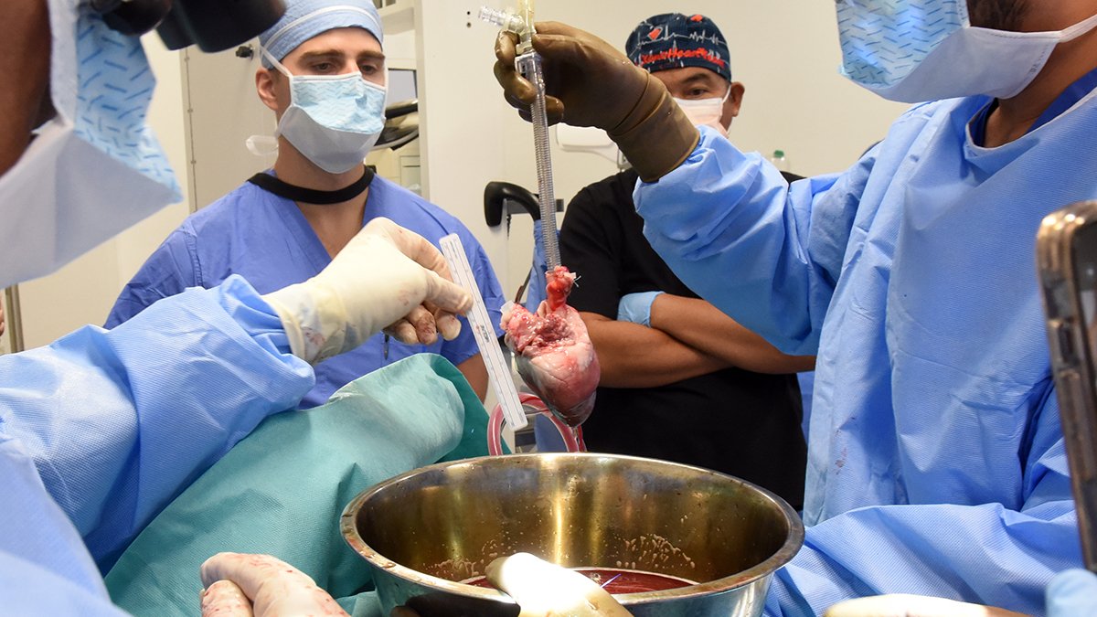 Man who received second pig heart transplant dies, hospital says – NBC Chicago - Vimarsana News