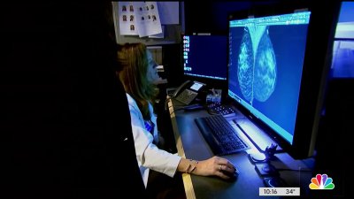 You and AI: Artificial intelligence and detecting breast cancer