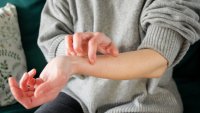 What causes skin to itch? New research pinpoints a previously unknown factor