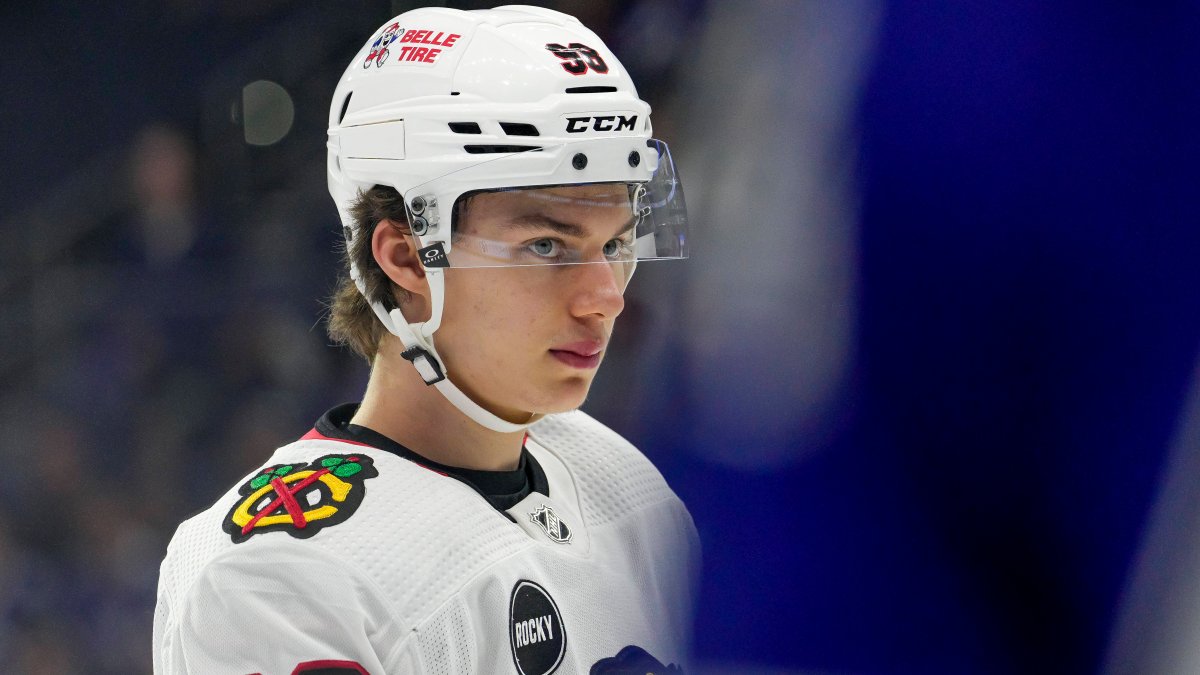 Connor Bedard Injury Update: Hawks star undergoes jaw surgery – NBC Chicago