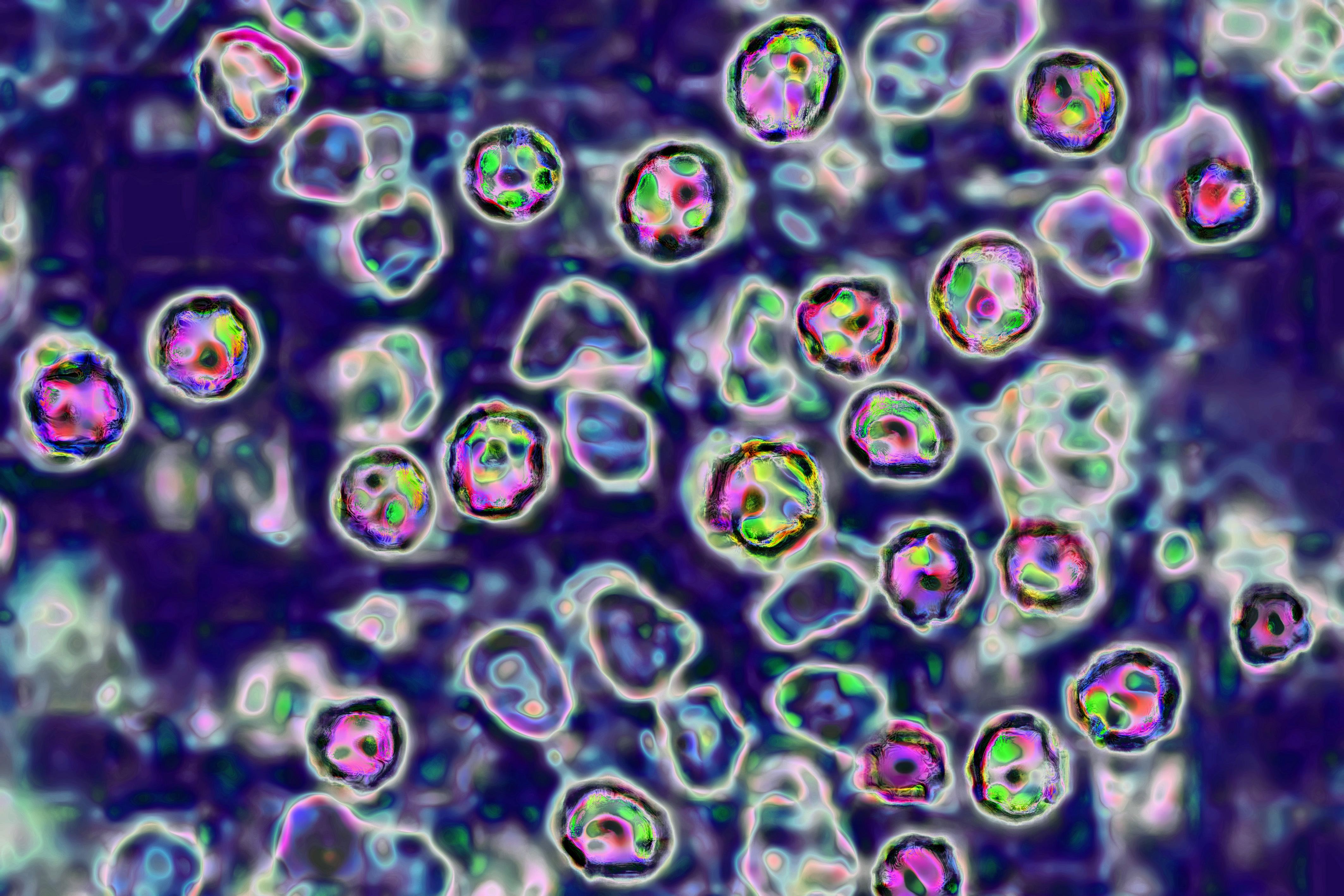 Chicago confirms 2 new measles cases, including 1 from outside Pilsen migrant shelter, bringing total to 10