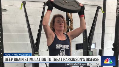 Rush Hospital patients seek out deep brain stimulation for Parkinson's Disease treatment