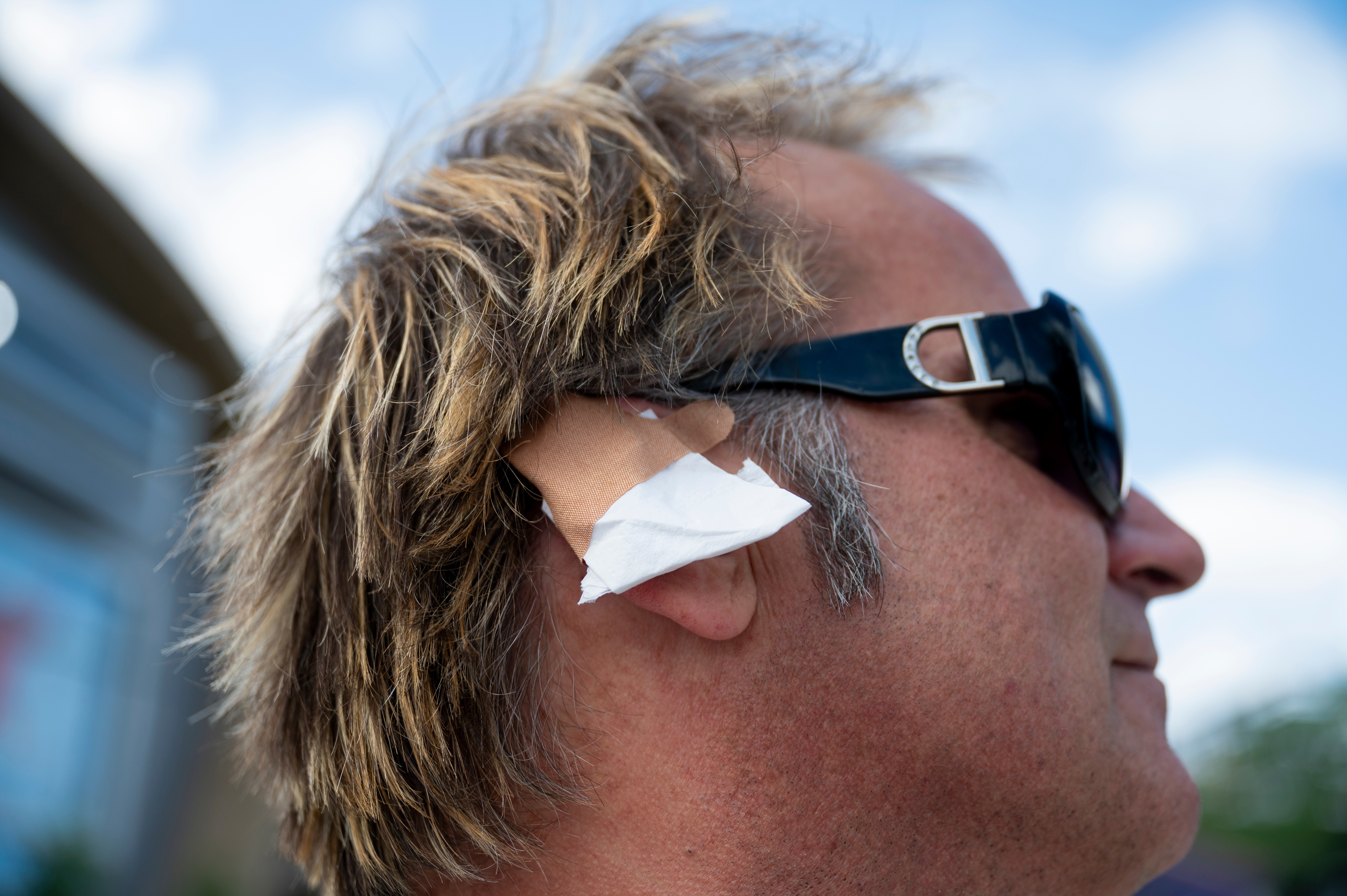 A delegate wears an imitation ear bandage during the Republican National Convention (RNC) outside the Fiserv Forum in Milwaukee, Wisconsin, US, on Wednesday, July 17, 2024. The RNC chairman warned against complacency when his party concludes its official nominating jamboree this week with polls predicting ex-President Donald Trump prevailing over President Joe Biden in the November election. Photographer: Vincent Alban/Bloomberg via Getty Images