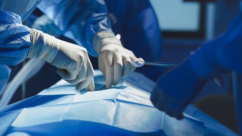 Close-up of surgeon with nurse and and assistant during operation in operating room.