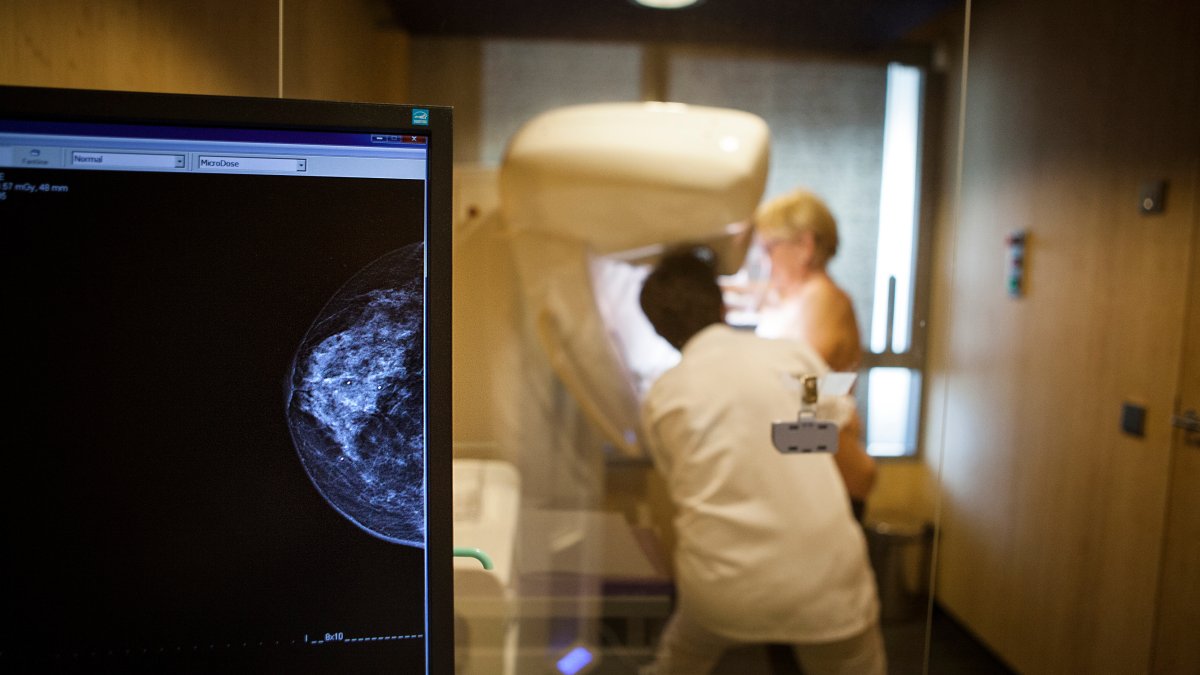 Dense breasts can make it harder to spot cancer on a mammogram NBC