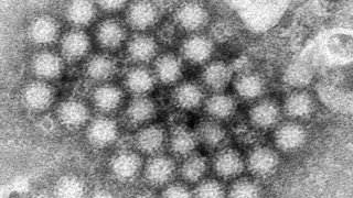 Norovirus