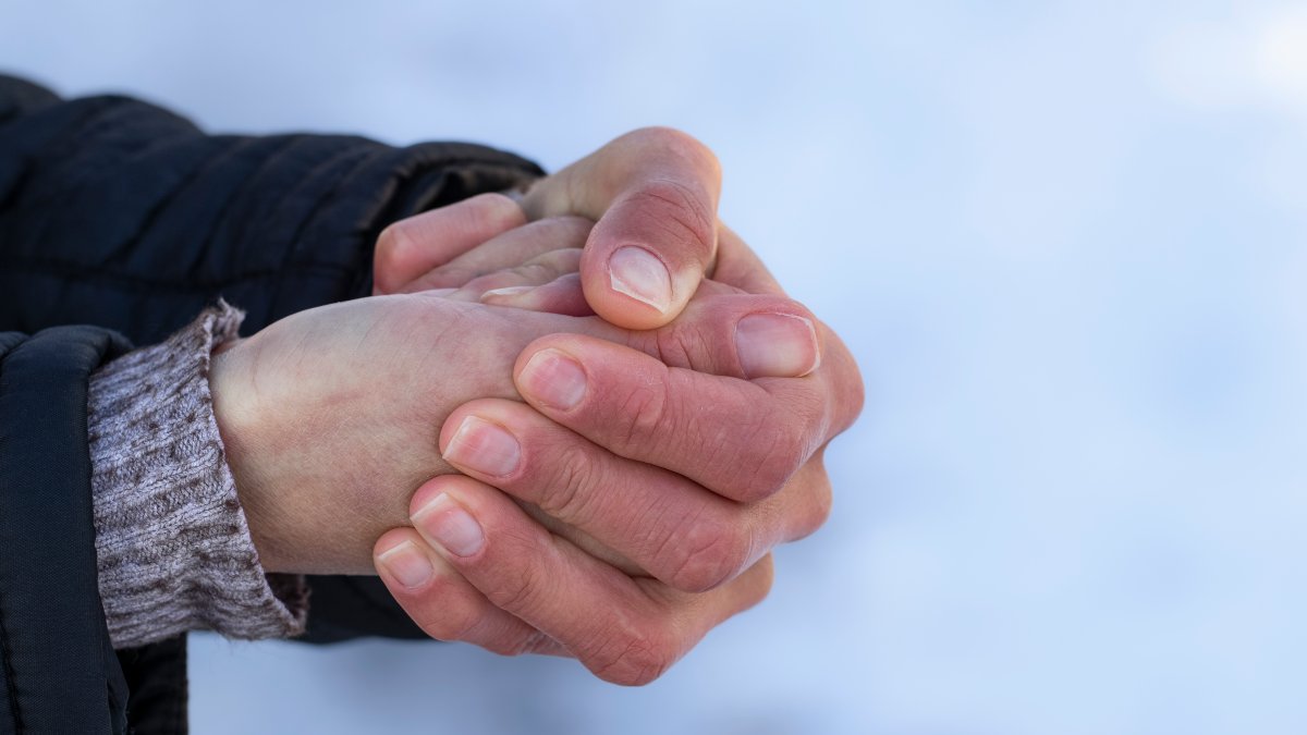 Dehydration, frostbite and more can occur during the extreme cold. Heres how to stay safe