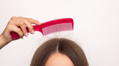 Why is your hair so staticky right now? Experts weigh in – NBC Chicago