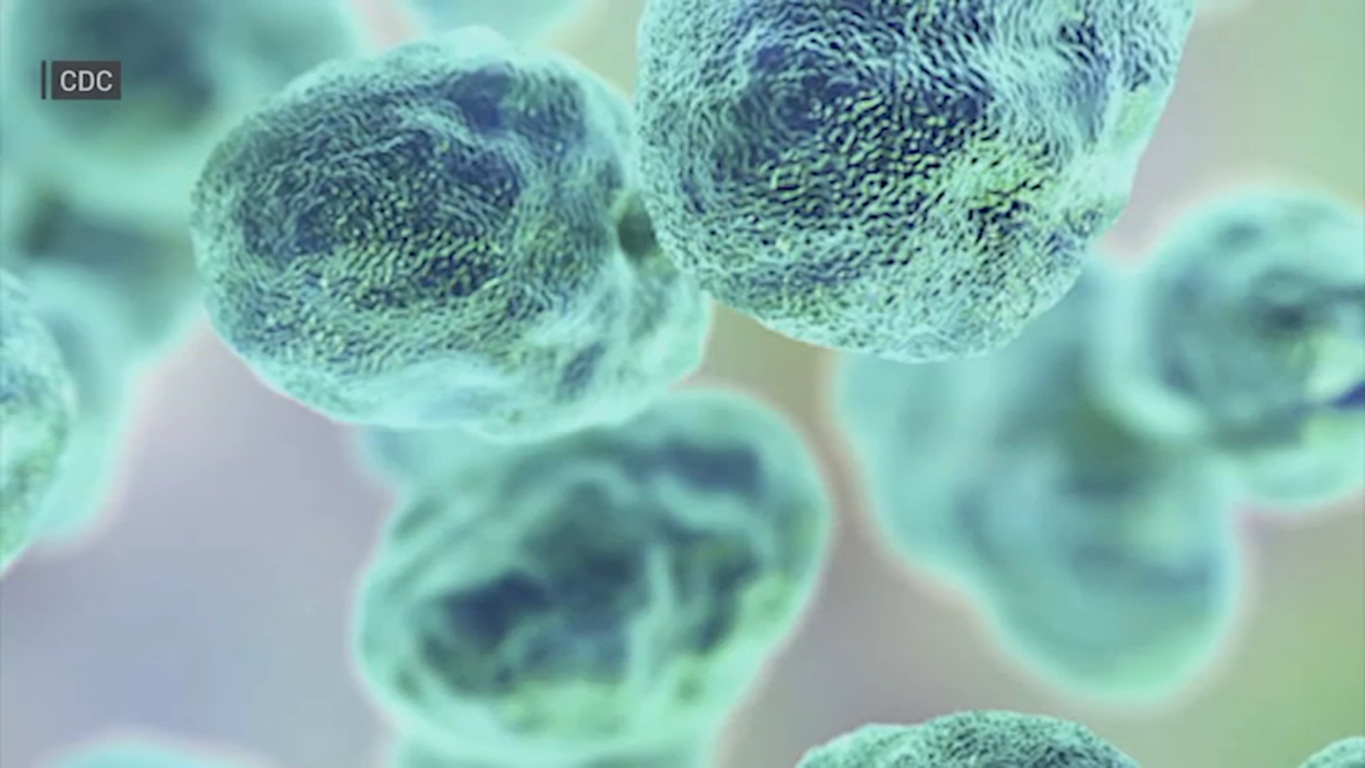Protecting pets amid Tularemia bacteria detection in Illinois: Spread, signs to watch for