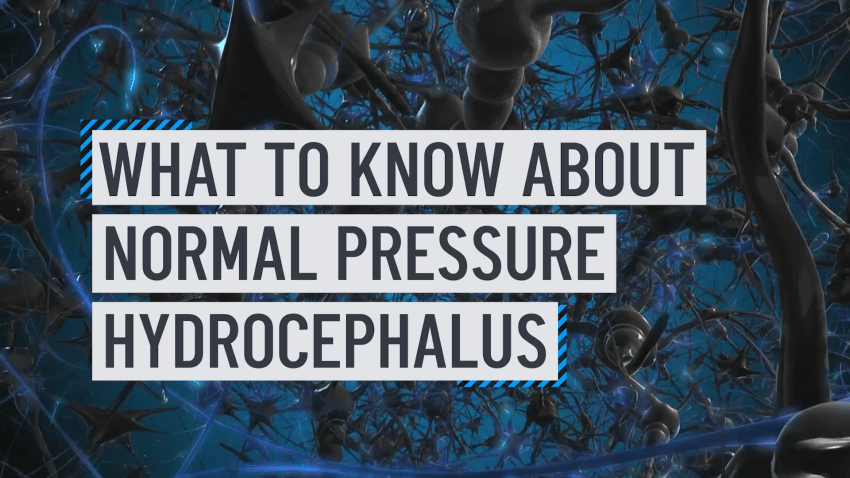 Text reading what to know about normal pressure hydrocephalus
