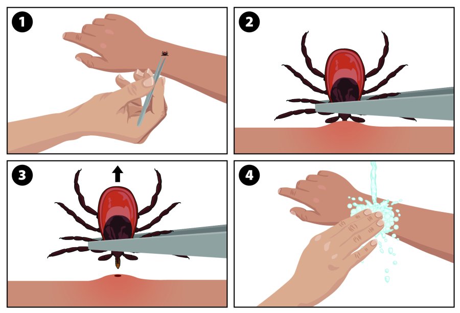 Tick removal diagram