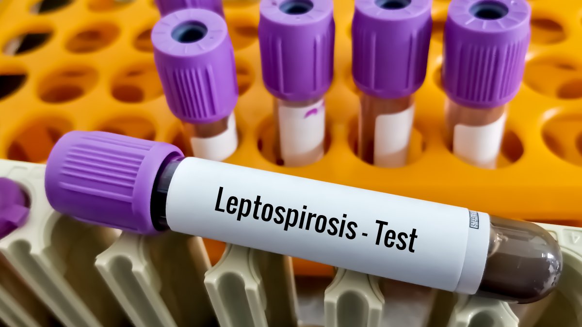 Leptospirosis death reported as Chicago issues health alert – NBC Chicago