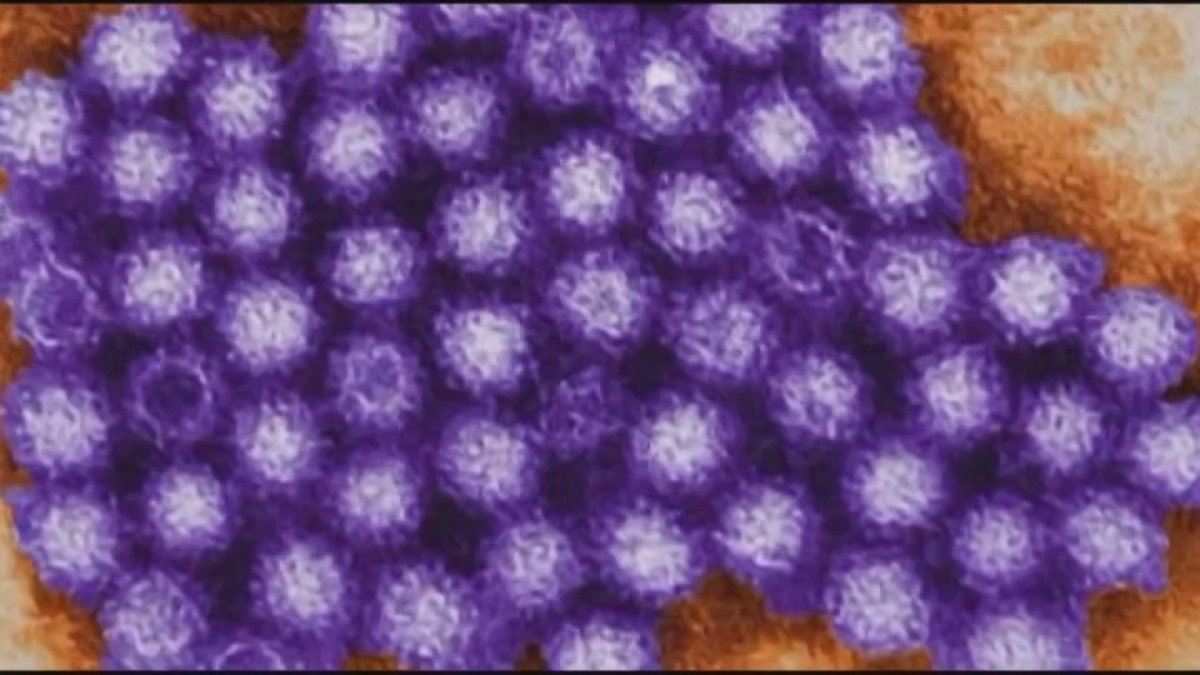 Highly contagious, hard-to-kill stomach virus spreading in Midwest, Illinois