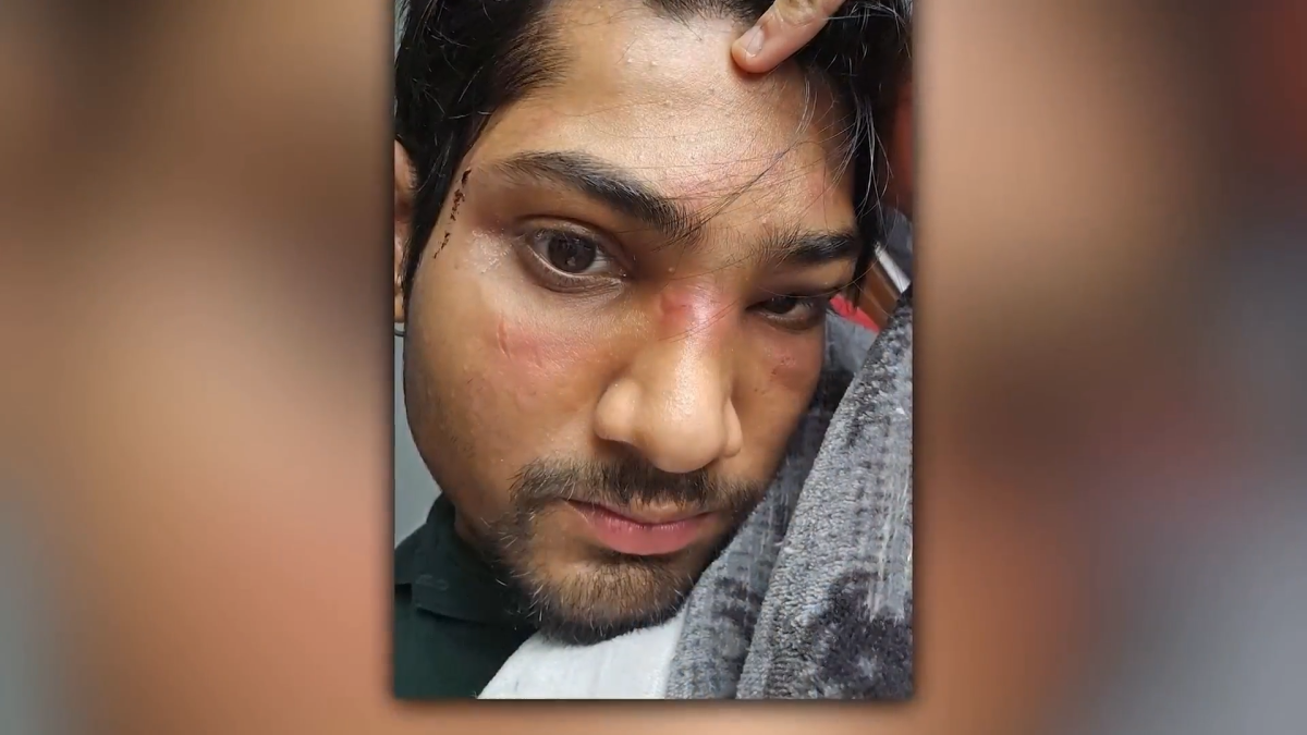 Student attacked on CTA says conductor told him to move cars after call for help