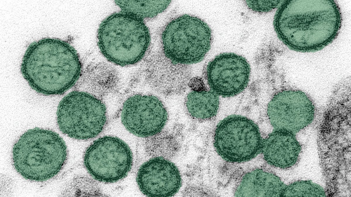 Could hantavirus be the next pandemic? Experts weigh in amid cruise ship outbreak