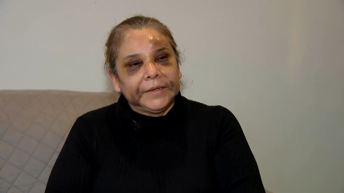 Clerk robbed by suspect in fatal officer shooting says it's a miracle she survived