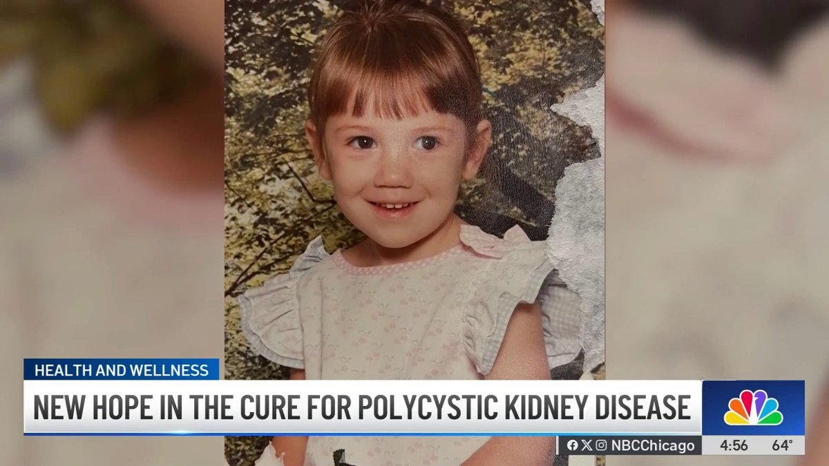 Polycystic Kidney Disease the target of a new federal bill