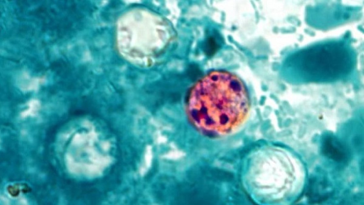 Cases of ‘explosive diarrhea parasite soaring in Michigan, Illinois Cases of ‘explosive diarrhea parasite soaring in Michigan, Illinois