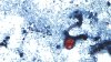 How to stay safe from the diarrhea-causing parasite and still enjoy produce