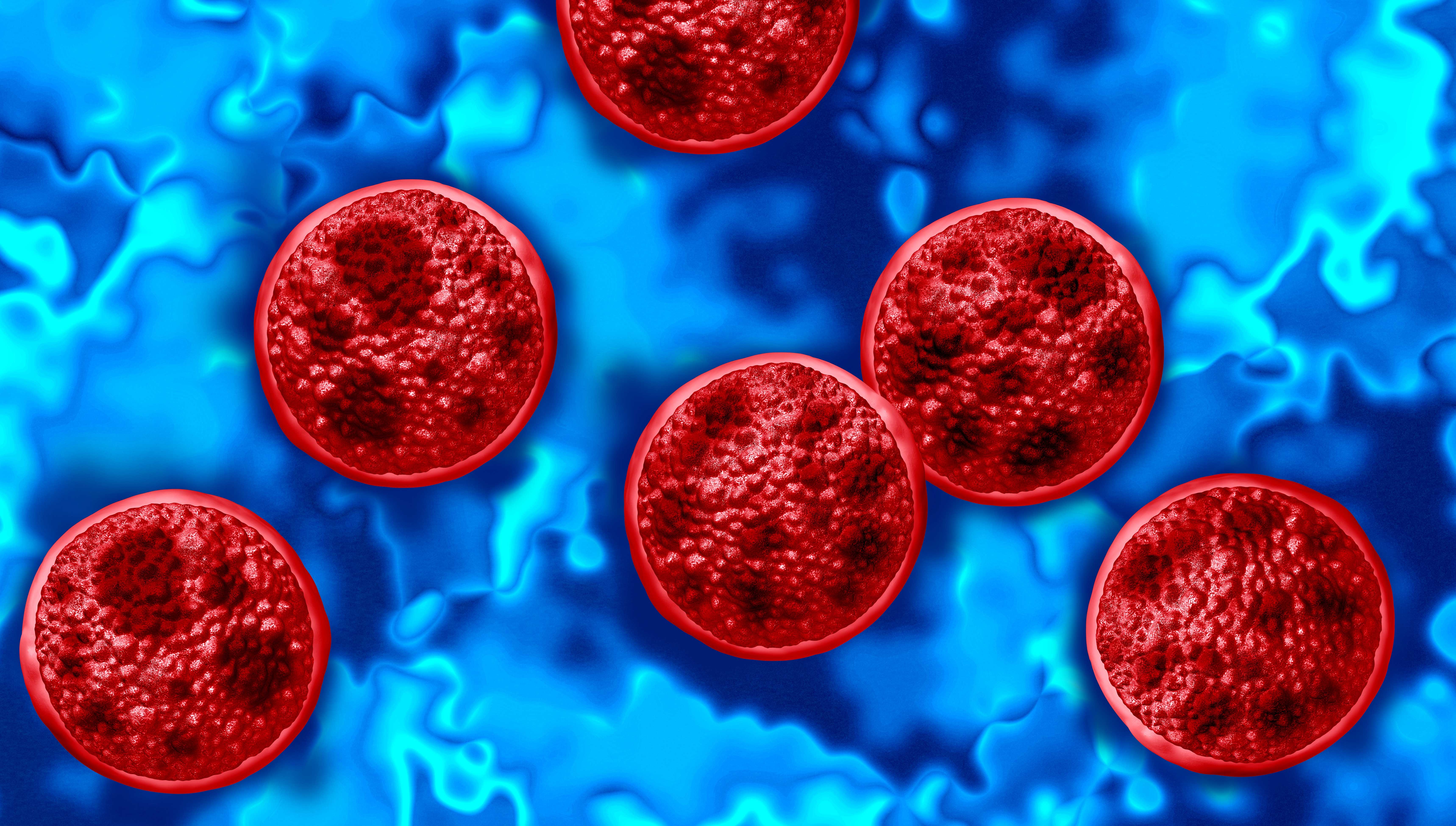 Michigan reports two deaths in cyclosporiasis outbreak