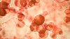 Drug-resistant fungal infections are spreading in U.S., Illinois. What to know