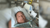 Given 6 months to live, Chicago man credits second opinion for saving his life