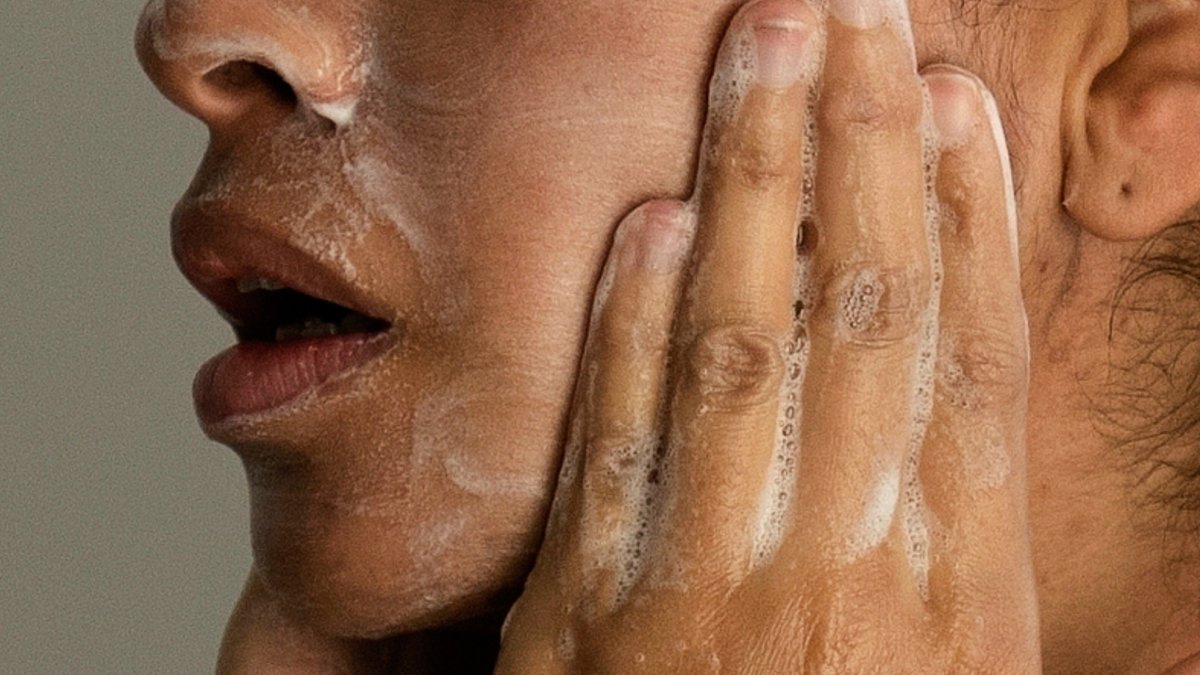 Adult acne is real, but there are ways to treat it. Here's what to know