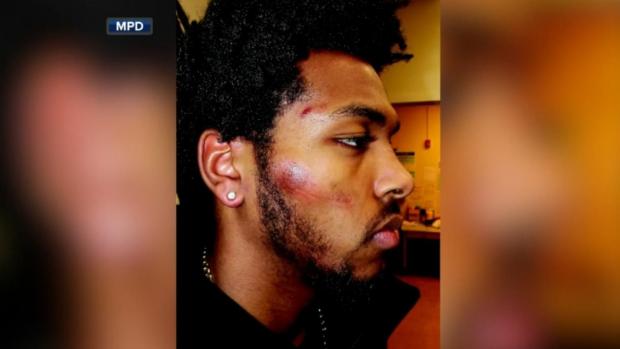 [NATL-CHI] Newly-Released Videos Show More on Sterling Brown Arrest