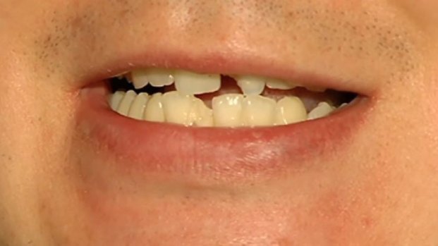 [CHI] Victim Tells Tale of Mob Beating